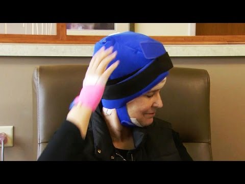 Cold caps help cancer patients keep their hair