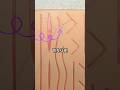 The Figure of Eight Stitch #howto #surgery #stitches #suturing #medicine