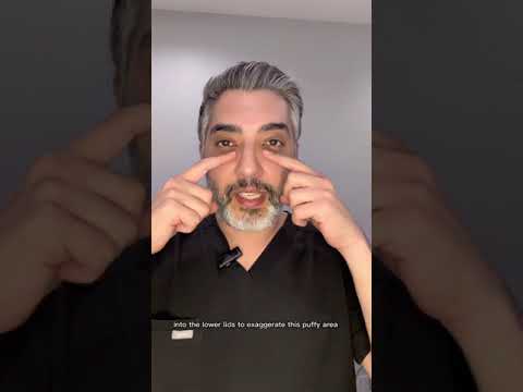 The Dangers of Aegyo Sal Fillers: What You Need to Know