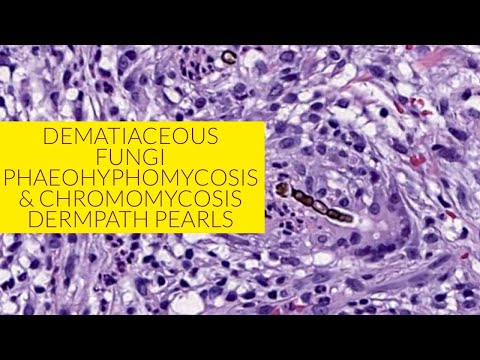 Mycosis a péniszen, A péniszen lévő pattanások - Anatómia September
