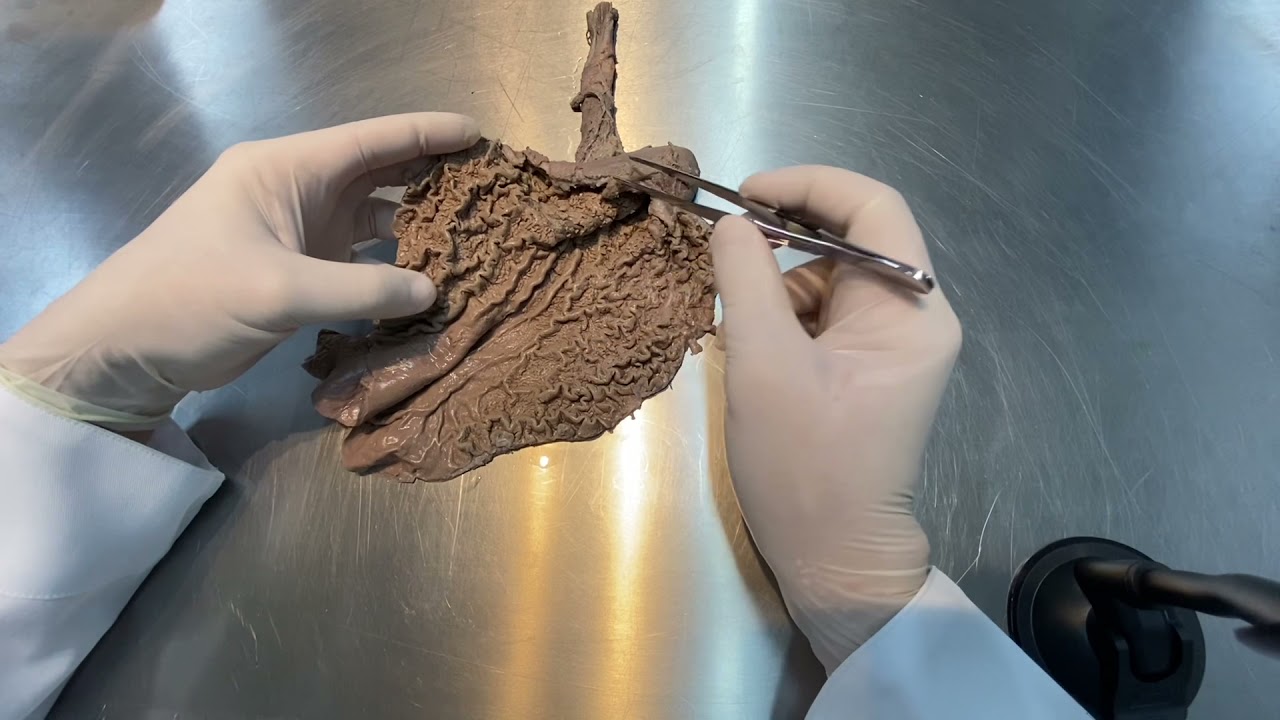 Estômago - Anatomia e funções gerais