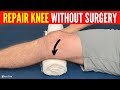 How To Heal And Repair Your Knee WITHOUT SURGERY