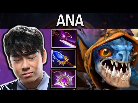 Slark Dota 2 Gameplay Ana with 28 Kills and Epic Build
