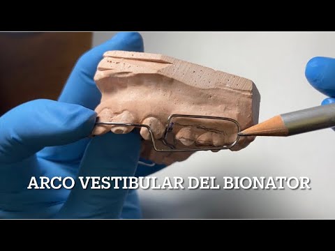 Vestibular Arch of the Bionator