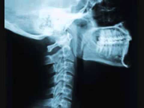 F/A 135: Morgue - Coma