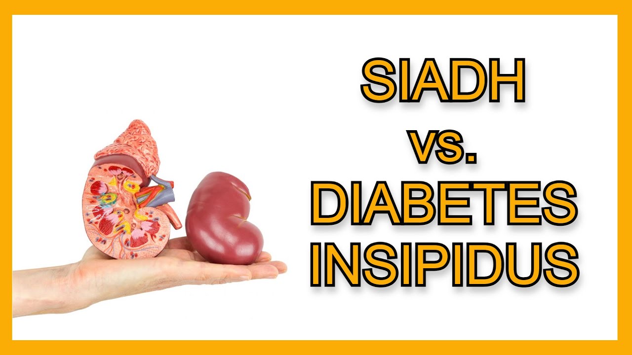 SIADH vs. Diabetes Insipidus