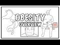 Approach to OBESITY and Weight gain - causes, risk factors, BMI, complications and treatment