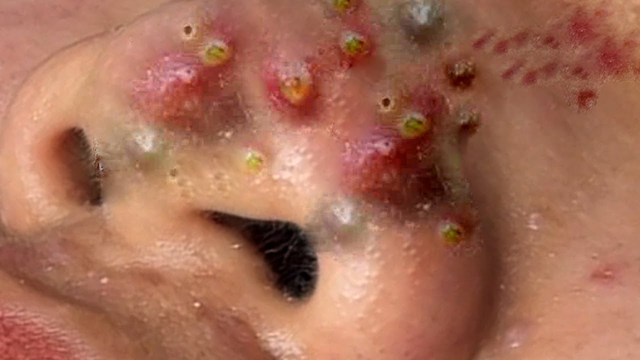 YouTube Thumbnail Downloader FULL HQ IMAGE