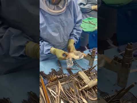 Direct Anterior Total Hip Replacement