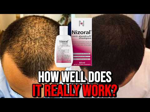 Ketoconazole Shampoo for Hair Loss - Ultimate Guide