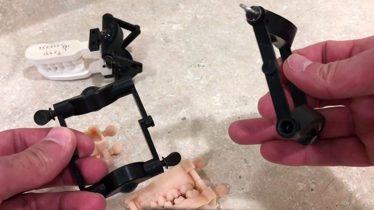 Twister Articulator in Exocad and 3Shape