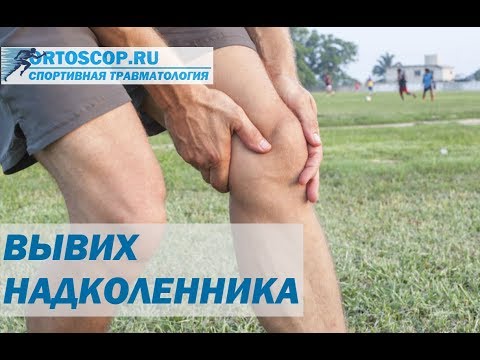 ВЫВИХ НАДКОЛЕННИКА. СПОРТИВНАЯ ТРАВМАТОЛОГИЯ