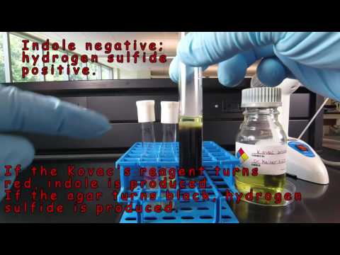 SIM Medium: Detection of Indole and Hydrogen Sulfide Production