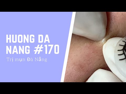 #170 | Huong Da Nang