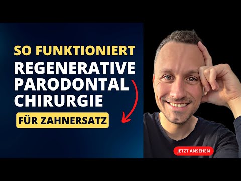 Regenerative Parodontologie 😍 | Zahnarzt Dr. Maximilian Fuhrmann