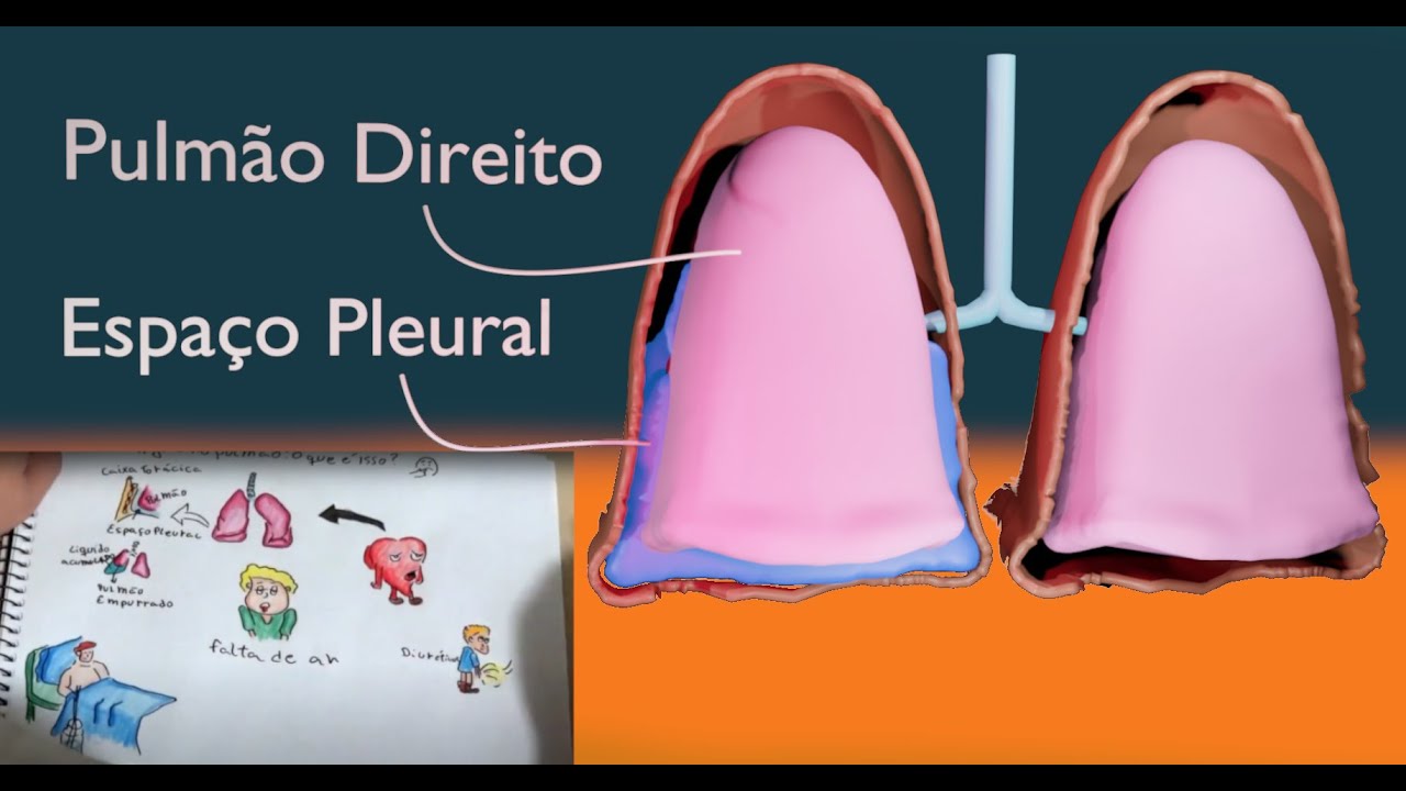 Água no Pulmão (vídeo novo)