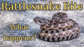 Rattlesnake bite: what happens?
