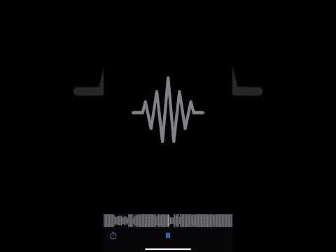 OY QUAN - EVERYTHING 4 NOTTI ( UNRELEASED ) 🔥