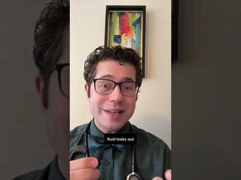 What you need to know about cold-induced hives (urticaria) #allergies #hives #cold