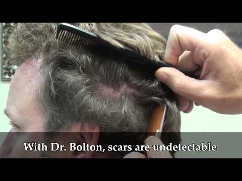 Patient 102 Undetectable Scar