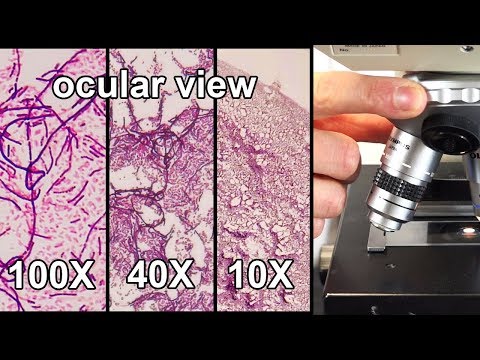 image-What is the function of the high-power objective on a microscope?