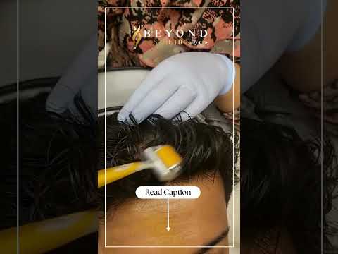 Hair Revive Cocktail | Beyond Aesthetics Ns3