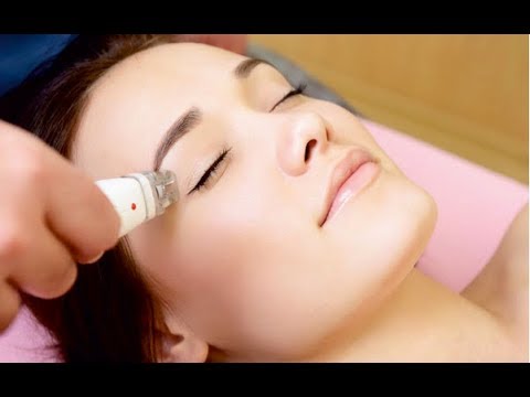 Carbon facial with laser at Delight Clinic