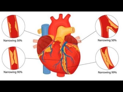 امراض القلب بالانجليزي Heart diseases in english