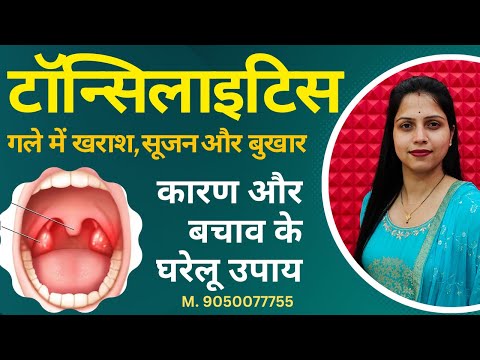 Tonsils Treament Story