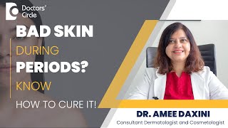 Why do we get Period Acne & How to get rid of it? #acne #periods - Dr. Amee Daxini | Doctors