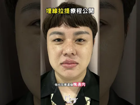 youtube-video-thumbnail