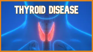 Thyroid Disease (Hyperthyroidism vs. Hypothyroidism)