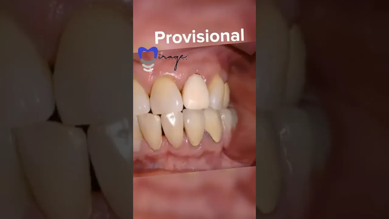 Video de Mirage Odontolab