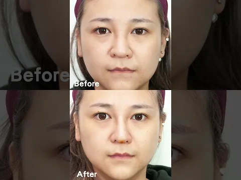 youtube-video-thumbnail