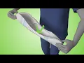 Tena Comfort Mini Super - 30 Pack video