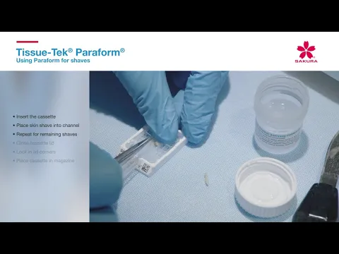 youtube-video-thumbnail