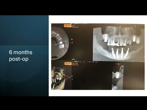 Video Title