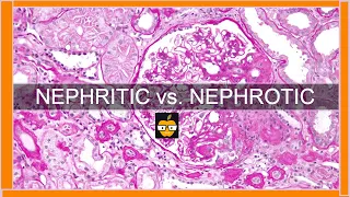 Nephritic vs. Nephrotic Syndromes