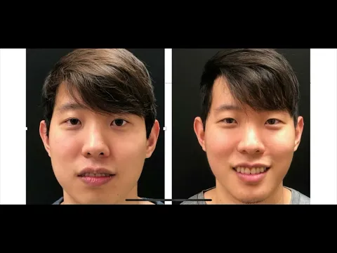 Case of Genial Deficiency by Dr. Tatch