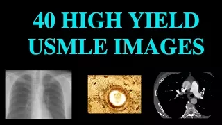 40 High Yield Images for USMLE (CT, XRay, Histology)