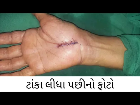 youtube-video-thumbnail