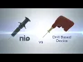 NIO Adult™ 15g Intraosseous Access Device video