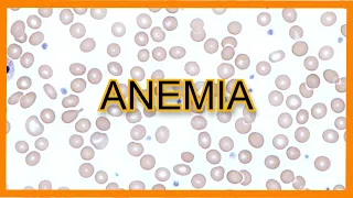 Anemia (Types, Findings, Lab Values)