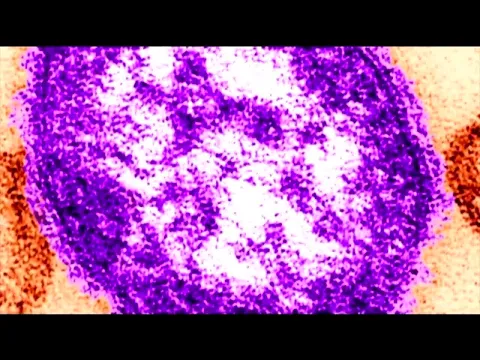 youtube-video-thumbnail