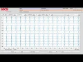 Seca CT321 PC-Based ECG Machine - Bluetooth Version video