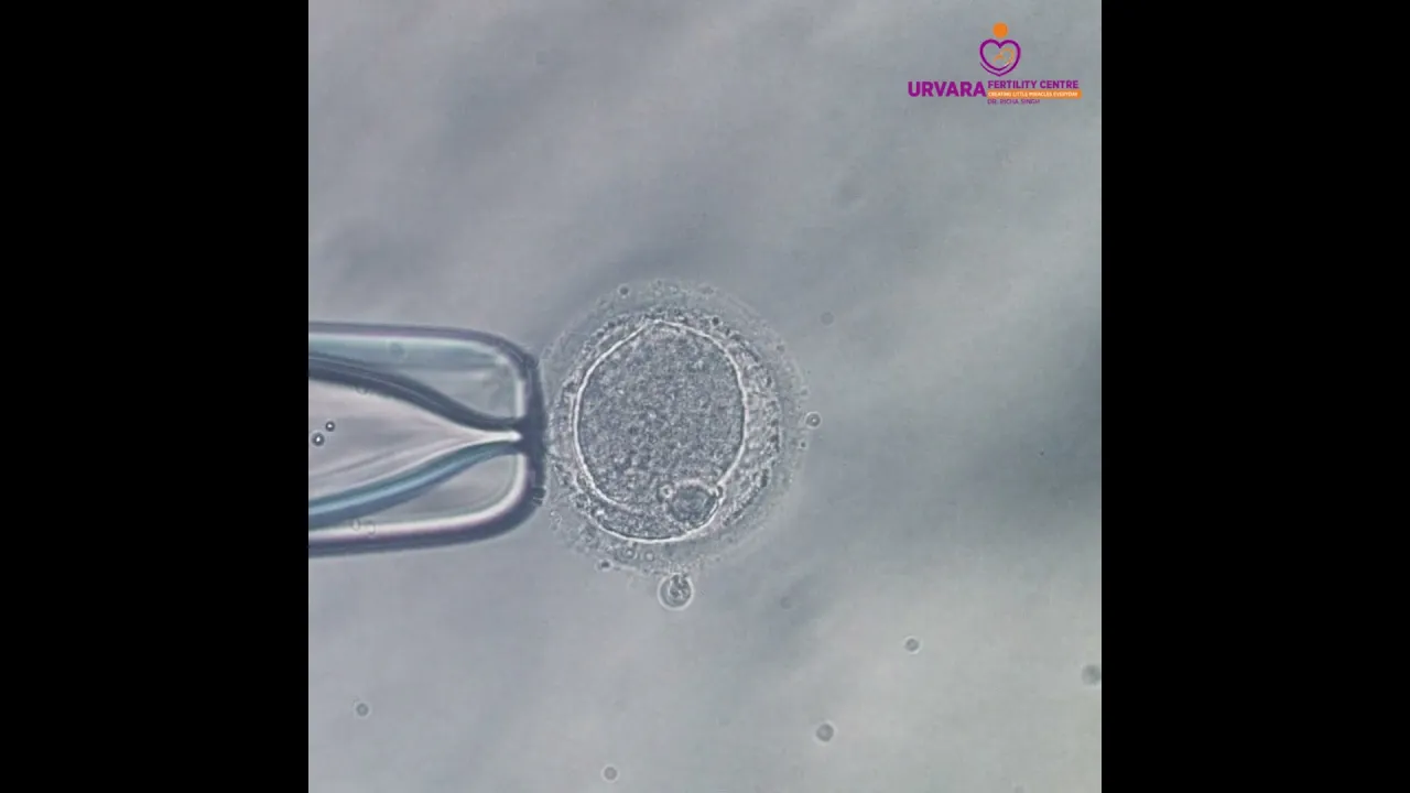 IVF Treatment Video