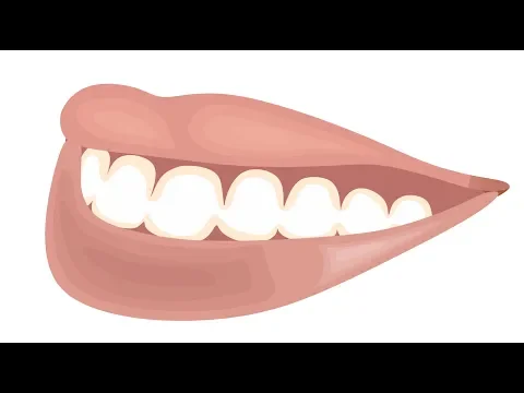 CURSO COREL DRAW DESENHAR BOCA TUTORIAL CARICATURAS