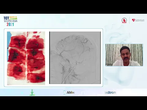 youtube-video-thumbnail