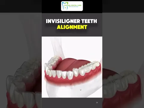 youtube-video-thumbnail