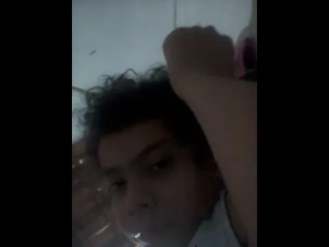 O PATATI CORTOU O DEDO EM UMA BRINCAÇÃO